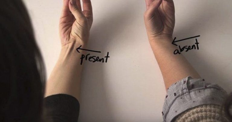 This is proof of evolution you can find on your own body : The Hearty Soul